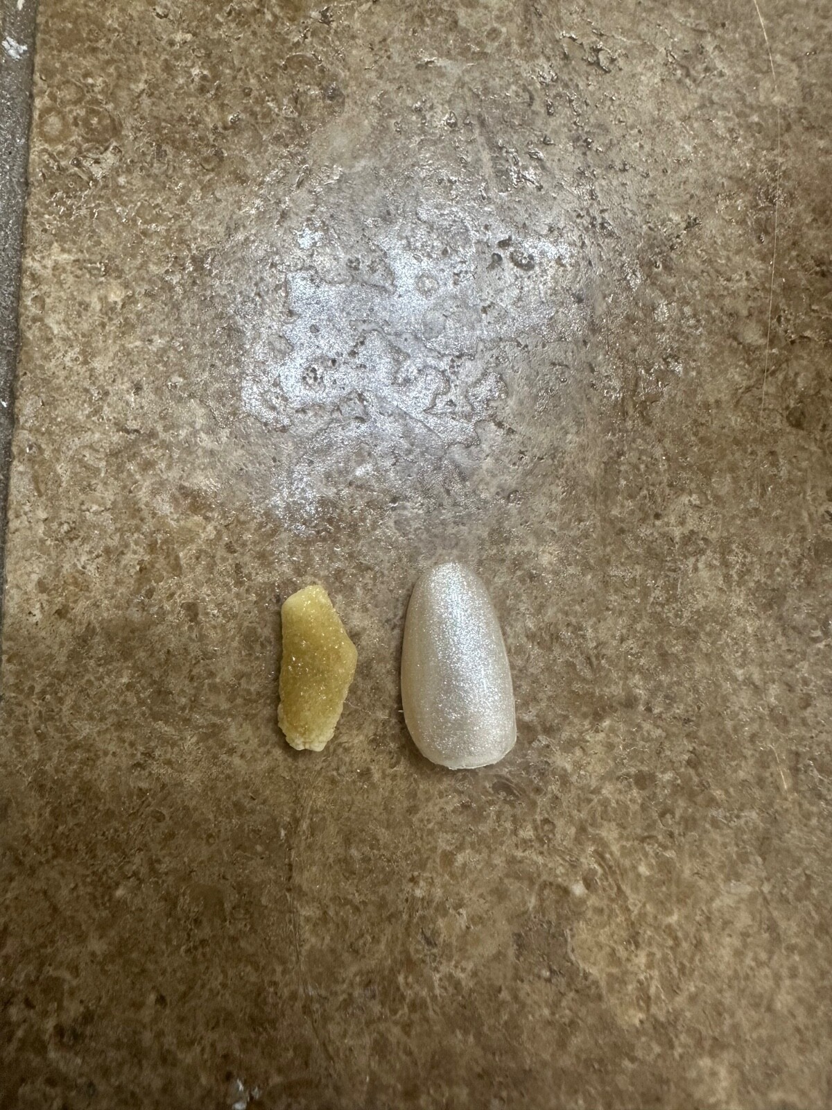 Real and Rare Kidney Stone, .7 inches, Cystine Stone, Super Rare Real and Rare Kidney Stone, .7 inches, Cystine Stone, Super Rare
