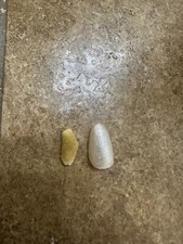 Real and Rare Kidney Stone, .7 inches, Cystine Stone, Super Rare picture