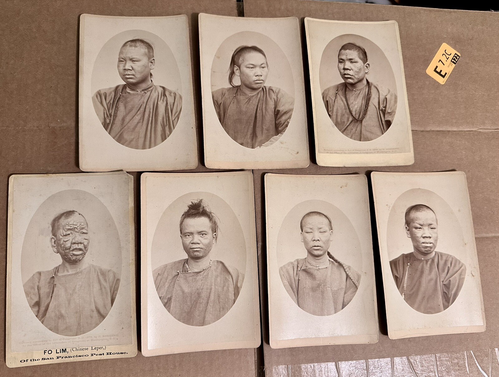 HISTORICALLY SIGNIFICANT CHINESE LEPERS SAN FRANCISCO RARE MEDICINE 19th Century